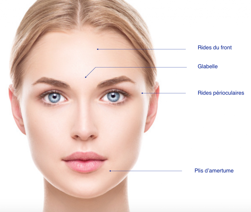 Injection de botox, toxine botulique à Strasbourg Dr FERRY